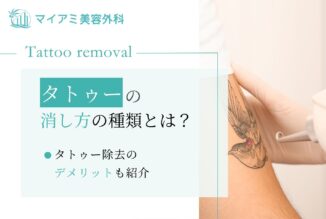 タトゥーの消し方の種類とは？完全に消し去ることは不可能？