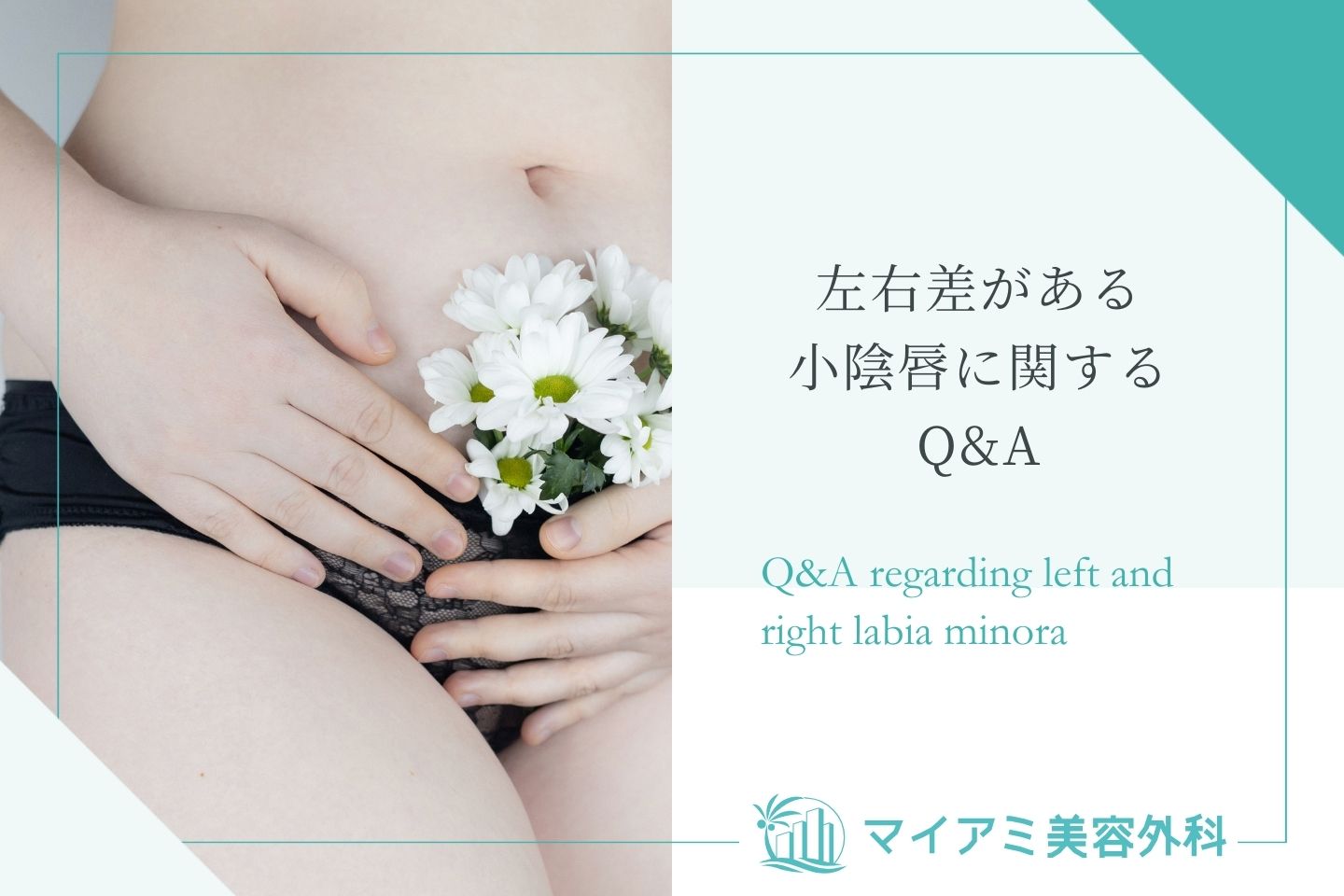 左右差がある小陰唇に関するQ&A