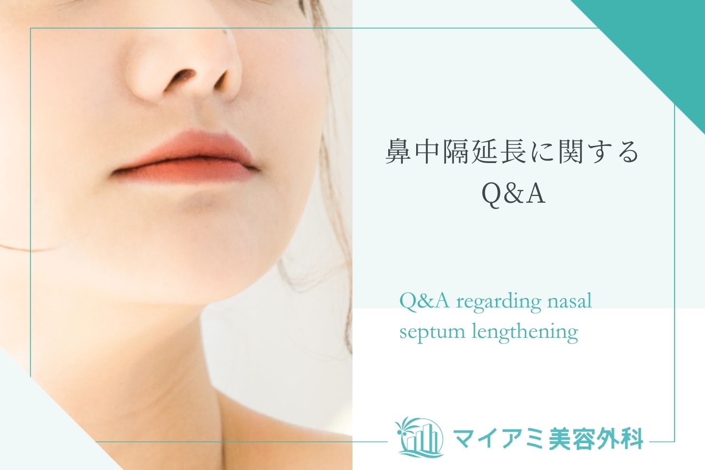 鼻中隔延長に関するQ&A