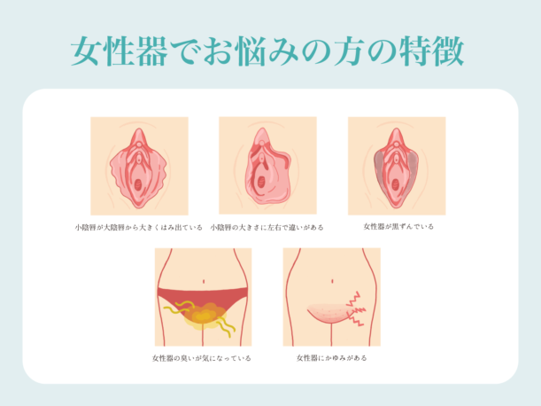 女性器でお悩みの方の特徴