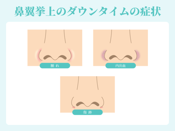 鼻翼挙上のダウンタイムの症状