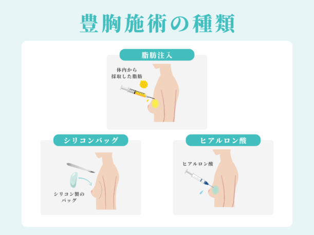 豊胸施術の種類